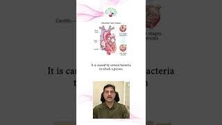 Understanding Valvular Heart Conditions l Dr Suhas Hardas