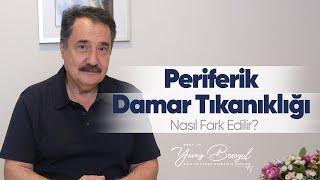 Periferik Damar Tıkanıklığı Nasıl Fark Edilir? | Kalp ve Damar Cerrahisi - Prof. Dr. Yavuz Beşoğul