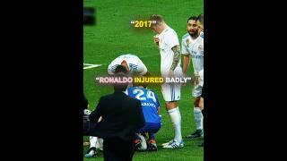 Ronaldo's Face injury 