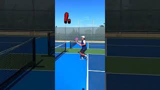 PICKLEBALL KITCHEN RULES ARE SO CONFUSING! #pickleball #pickleballtips #enhancepickleball