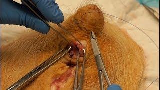 3rd and 4th Degree Perineal Laceration Repair