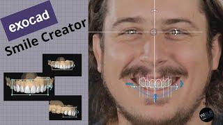 Exocad - Smile Creator