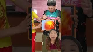 STOMACH SCAN HAS BALLERINA CAPPUCCINA ‼️ | Skolastika Adriana #shorts