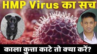 HMP Virus का सच | काला कुत्ता काटे तो क्या करें ? Dr BRC | National Health