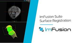 ImFusion Suite Computer Vision Module: 3D Surface to Medical Image Registration