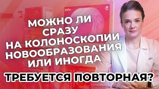 Можно ли сразу на колоноскопии удалить все новообразования или иногда требуется повторная?