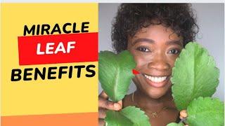 8 Benefits of Miracle leaf /leaf of life/bryophyllum pinnatum / uses