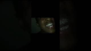 XXXTentacion Shows Off New Grills #explore #explorepage #foryou