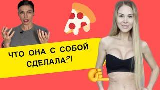 Мася Шпак уговаривает уменьшить желудок ? | Как быстро похудеть | Как похудела Мася Шпак #масяшпак