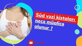 Süd Vəzi Kistaları Necə Müalicə Edilir?