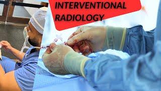 How to IR - Interventional Radiology