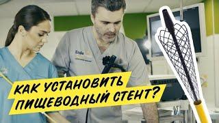 Видеоинструкция - саморасширяющиеся пищеводные стенты Эндо Старс (Endo Stars LLC). Часть 2.