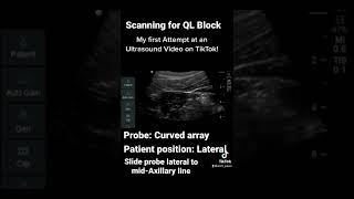 Scanning for Quadratus Lumborum Blocks - how to identify the muscle
