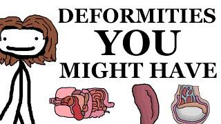 Deformities That You Might Have