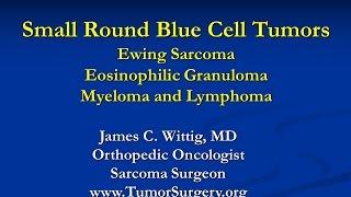 Orthopedic Oncology Course- Small Round Blue Cell Tumors (Ewing Sarcoma, Lymphoma) - Lecture 8