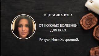 ОТ КОЖНЫХ БОЛЕЗНЕЙ. ДЛЯ ВСЕХ. ▶️ВЕДЬМИНА ИЗБА ▶️ ИНГА ХОСРОЕВА.