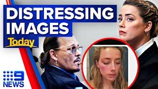 Shocking images of Amber Heard shown in Depp defamation trial | 9 News Australia