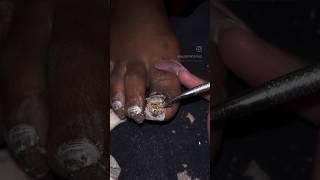 EXTREME TOENAIL TRANSFORMATION! WHAT HAPPENEDACRYLIC FRENCH TIPS #toenails #nailtutorial