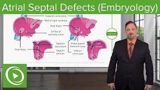 Atrial Septal Defects – Embryology | Lecturio