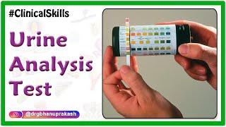 Urine analysis test procedure : Biochemistry Practicals