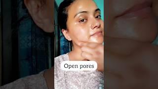 Dull Skin & Open Pores? 15 Min Mein Glow Karo #skincare #beauty #shorts #glowingskin