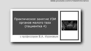 Практическое занятие: УЗИ органов малого таза.  Пациентка 4