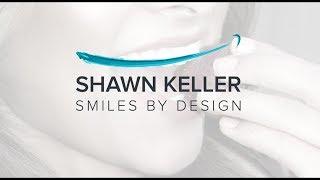 Cosmetic Dentures with Redmond, WA Dentist, Shawn Keller, DDS