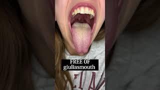 My mouth 