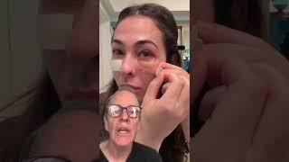 Step By Step Recovery from Eyelid Surgery