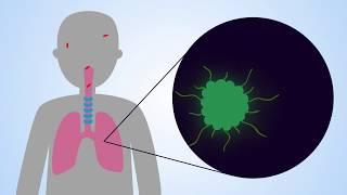 Immunotherapy using designer immune cells targeting infectious diseases