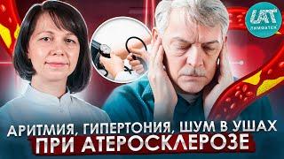 Аритмия, гипертония, шум в ушах при атеросклерозе сосудов шеи. Клинический случай.