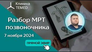 Прямой эфир "Разбор МРТ позвоночника" с Евдокимовым А.С.