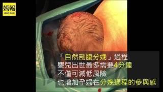 【媽報溫馨】剖腹生產實錄