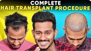 One of the Best Hair Transplant Result | Patient ka month by month Result or Personal Experience