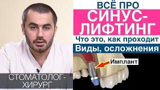 Синус-лифтинг: что это, когда необходим. Установка импланта после синус-лифтинга, закрытый, открытый