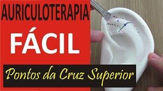 Auriculoterapia Fácil - Curso de Acupuntura Auricular