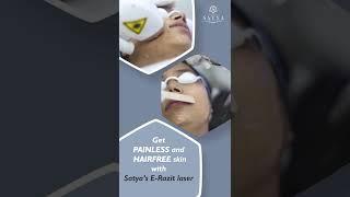 How to remove unwanted hair | Laser hair removal Treatment | Satya Skin Clinic | laser for skin