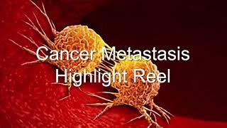 Cancer Metastasis Highlight Reel - Bioxytran $BIXT Takes on Cancer