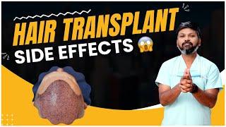 #AskDrJohnWatts | HAIR TRANSPLANT SIDE EFFECTS | Hair Specialist Explains