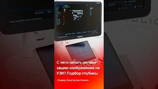 С чего начать оптимизацию изображения на УЗИ? Советы врача - смотрите на @medliga #short #shorts