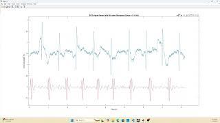 IIR Filters on FPGAs Part 3: Cascading Biquads (Higher Order Filters)