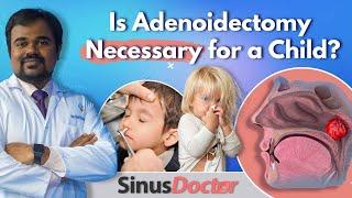 What are Adenoids | Causes | Symptoms [ Is Adenoidectomy Necessary for a Child? ] #SinusDoctor