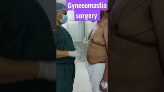 Gynecomastia surgery Bangladesh | Male breast reduction | Dr Iqbal Ahmed plastic surgery