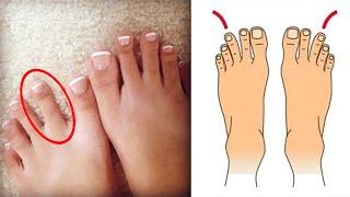 DO YOU HAVE THIS LONGER TOE?. THEN BEWARE WITH THE GREEK FOOT