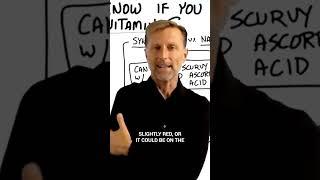 Dr. Berg explains dry skin and Vitamin C #drberg #dry #skin #vitaminc #sugar #keto #ketodiet