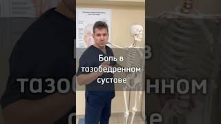 Боль в тазобедренном суставе #массаж #anatomy #тазобедренныесуставы