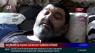 GEÇİRDİĞİ İŞ KAZASI İLE HAYATI KABUSA DÖNDÜ