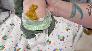 Huge Diaper Blowout!! Poop Explsion for silicone baby doll| nlovewithreborns2011