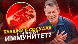 Как очистить сосуды от бляшек? Рассказываем о методе Лимфатек.