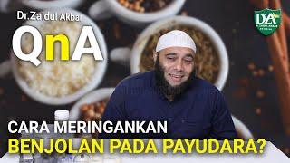 Cara Meringankan Benjolan Pada Payudara? - dr. Zaidul Akbar Official